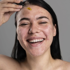 woman-using-special-oil-acne